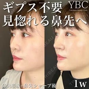 YBC横浜美容外科 大宮院 磯村 亮輔医師の症例