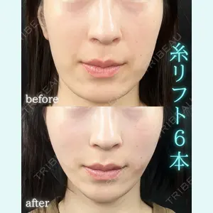 THE FIRST CLINIC 町田院 木暮 啓一郎医師の症例