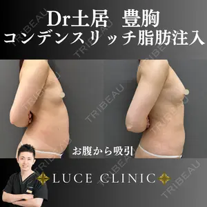症例