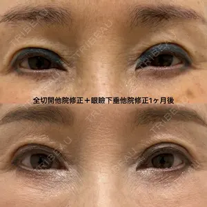 エターナル美容クリニック 久門田 詳医師の症例