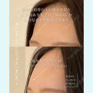 ROHE CLINIC GINZAの症例