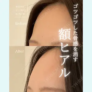 ROHE CLINIC GINZAの症例