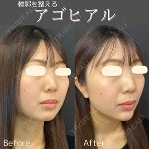 ルラ美容クリニック 仙台院 / ルラスキンクリニック 仙台院 橋本 英樹医師の症例