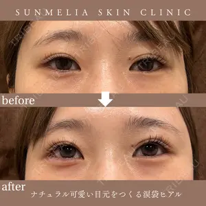 SUNMELIA SKIN CLINIC 中山 暁医師の症例