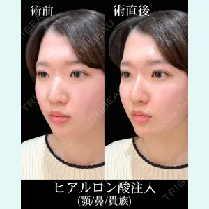 症例