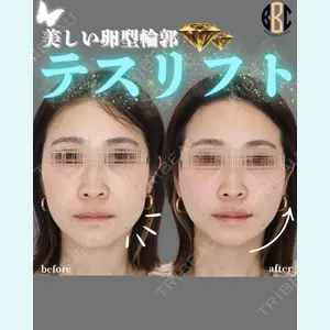 BON BON CLINIC 渋谷院 角野 智仁医師の症例