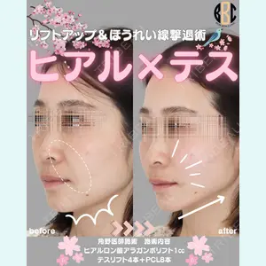 BON BON CLINIC 渋谷院 角野 智仁医師の症例