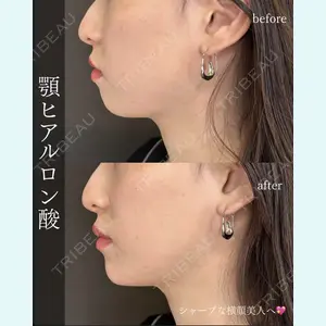 ルラ美容クリニック 大阪心斎橋院の症例