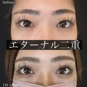 ルラ美容クリニック 大阪心斎橋院の症例
