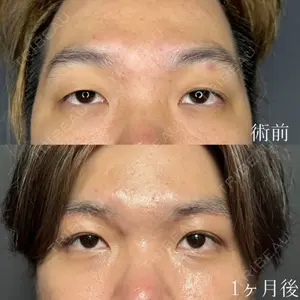症例