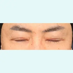 プリモ麻布十番クリニック 大場教弘医師の症例