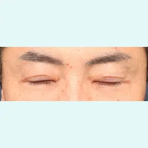 プリモ麻布十番クリニック 大場教弘医師の症例