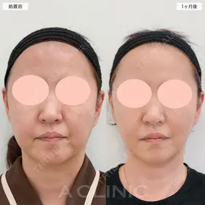 A CLINIC（エークリニック） 名古屋院 住田 篤紀医師の症例