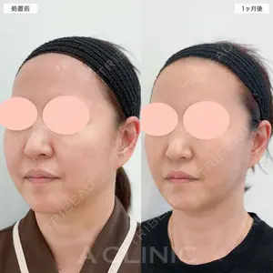 A CLINIC（エークリニック） 名古屋院 住田 篤紀医師の症例