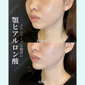 症例