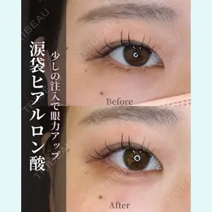 症例