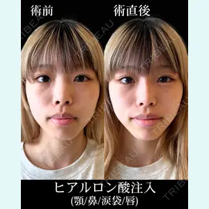 症例