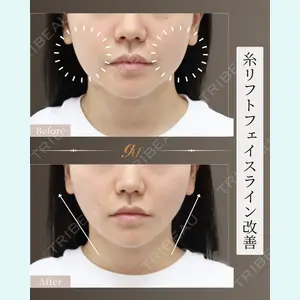 gift clinic 能登谷 翔医師の症例