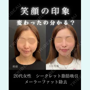 症例