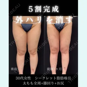 症例