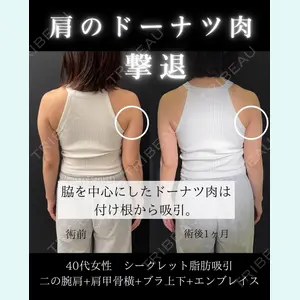症例