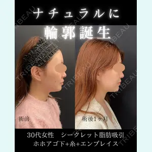 症例
