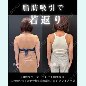 症例