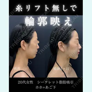 症例