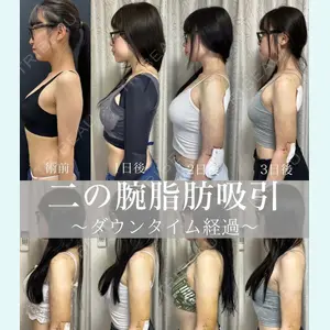 症例