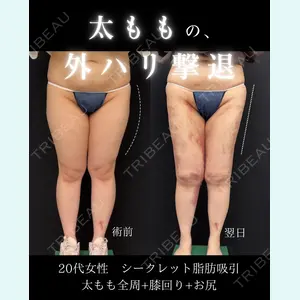 症例
