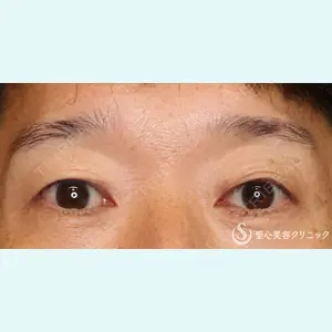 聖心美容クリニック 名古屋院 加藤 大典医師の症例
