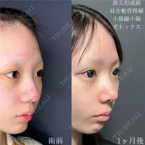 症例