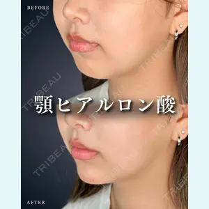 症例