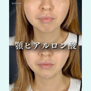 症例