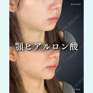 症例