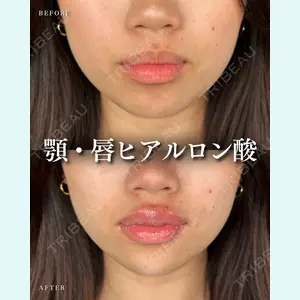ルラ美容クリニック 千葉院 / ルラスキンクリニック 千葉院 松岡 舟作医師の症例