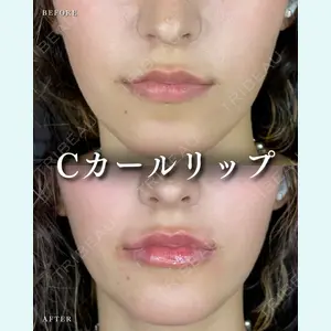症例