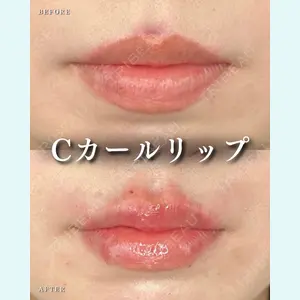 症例