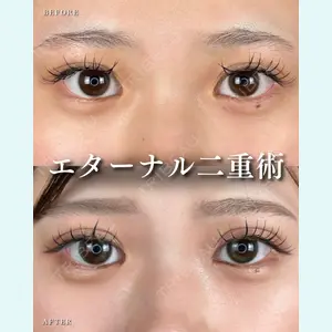 症例