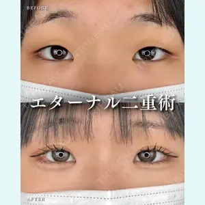 症例