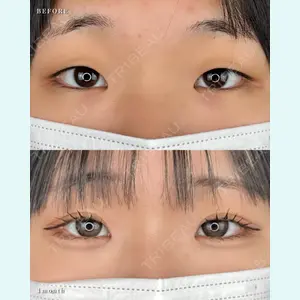 症例