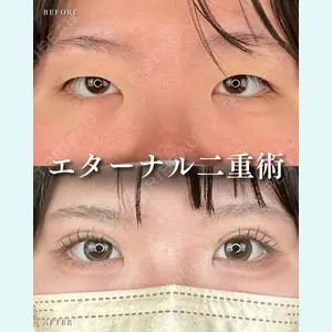 症例