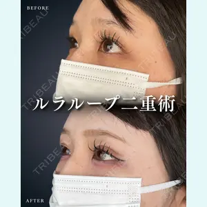 症例