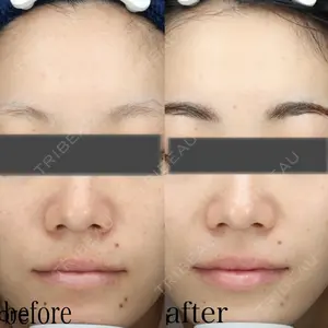 YVESJU CLINIC （イヴジュクリニック） 表参道院 佐々木 亨医師の症例