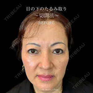 Code Beauty Clinic 名古屋院 橋本 祥平医師の症例
