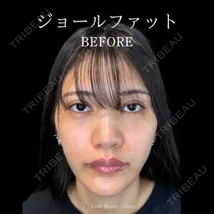 Code Beauty Clinic 名古屋院 橋本 祥平医師の症例