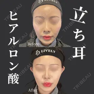 症例