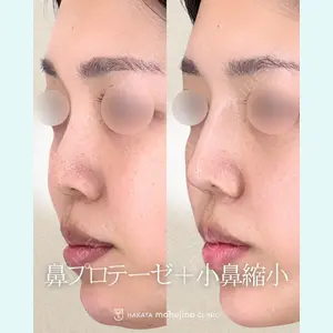 博多もへじのクリニック 村田 将光医師の症例