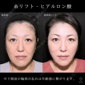 症例