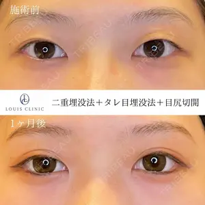 LOUIS CLINIC 二子玉川院【ルイクリニック】 小松 塁医師の症例